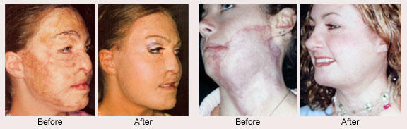 Does plastic surgery actually make a person look better?