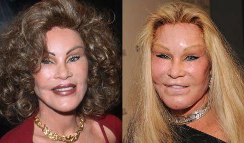 Does plastic surgery actually make a person look better?