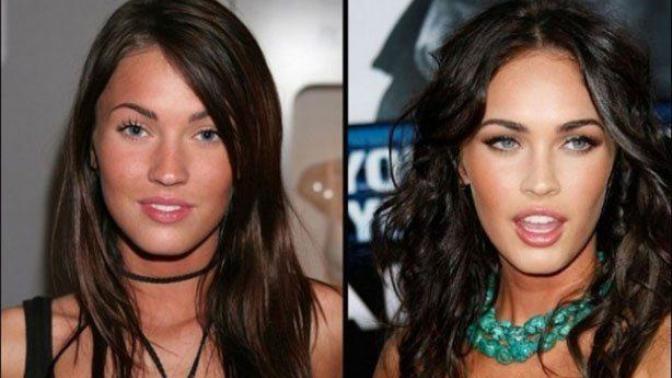 Does plastic surgery actually make a person look better?