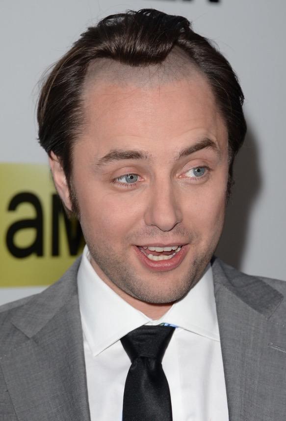 Females, would you date a guy who’s hairline has receded a lot?