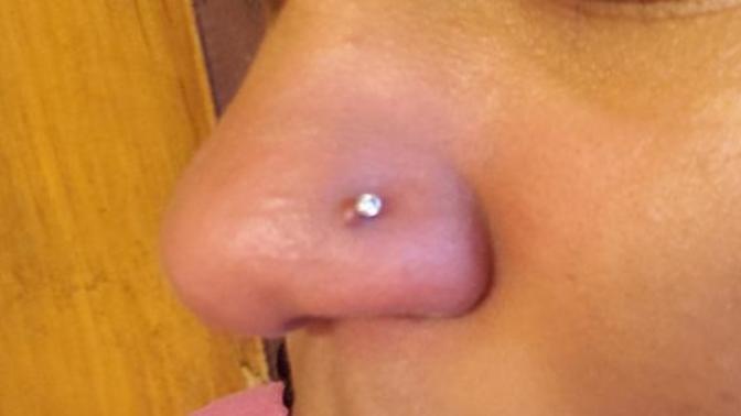 Does my nose piercing have a keloid?