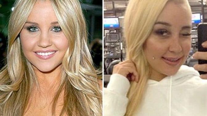 Does plastic surgery always improve someone's looks, such as a boob job?