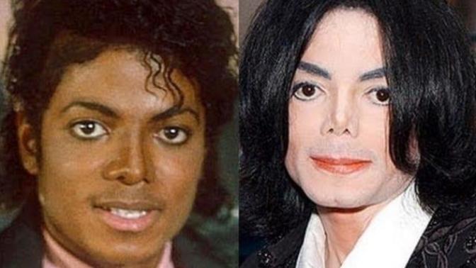 Part II of Does plastic surgery always improve a person's looks?