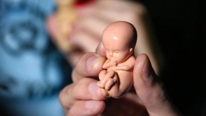What do you think about abortion ban?