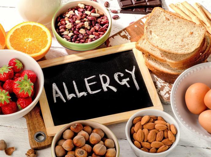 Do you have any food allergies?