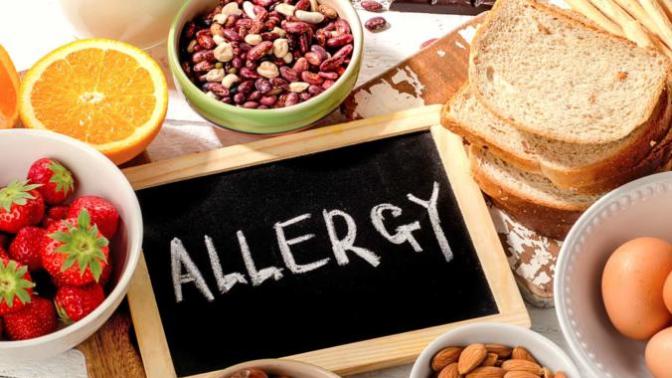 Do you have any food allergies?
