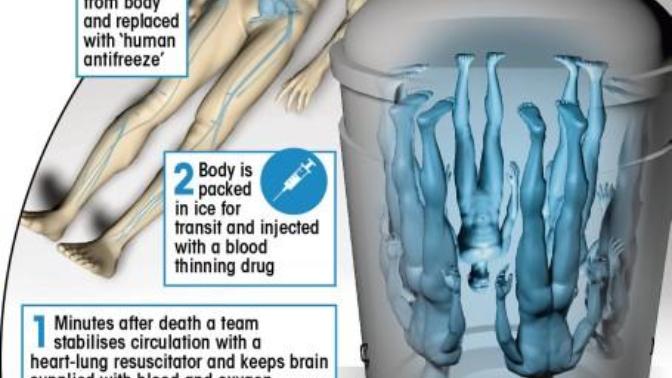 Cryonics. Would you sign up to be frozen in the hope of cheating death?
