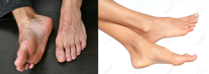 What's your favorite body part on the sex/gender you're attracted to?