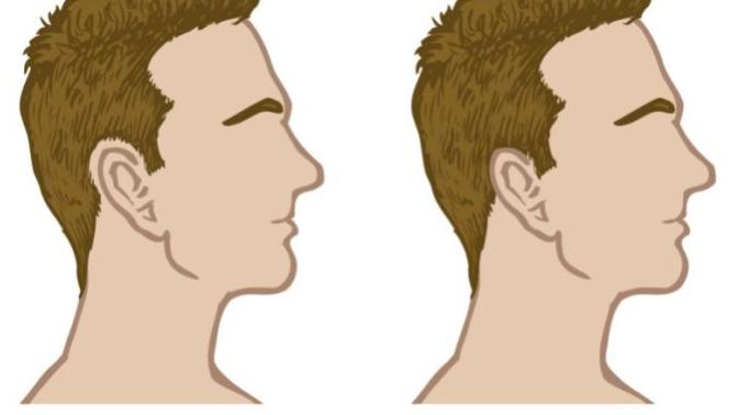 What is the best haircut for naturally high arch hair around the ear?