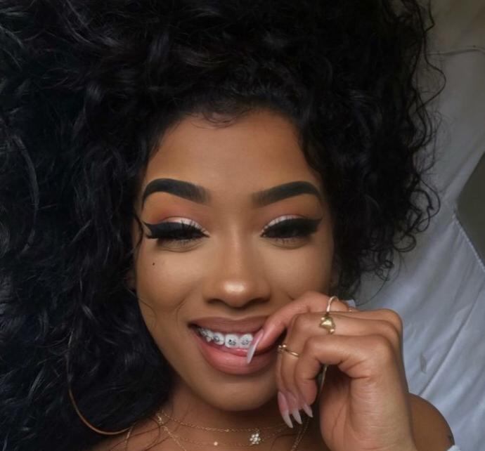 Thoughts on girls/boys with braces?