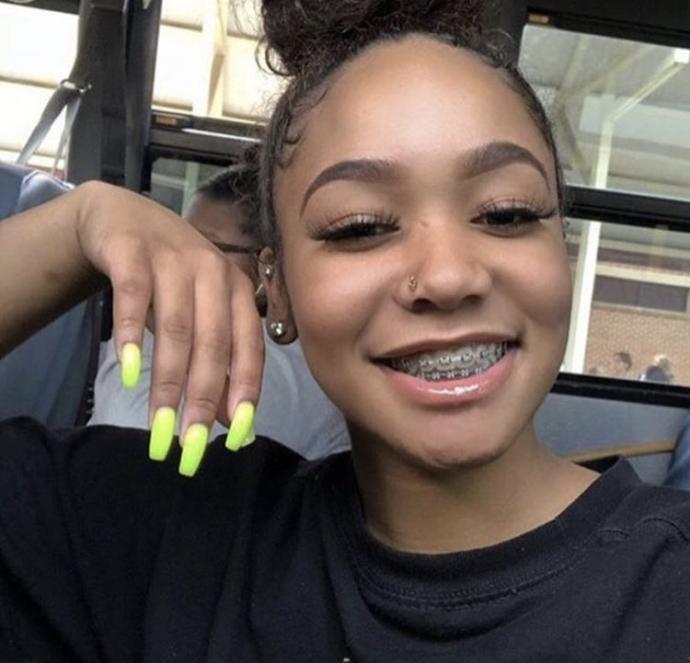 Thoughts on girls/boys with braces?