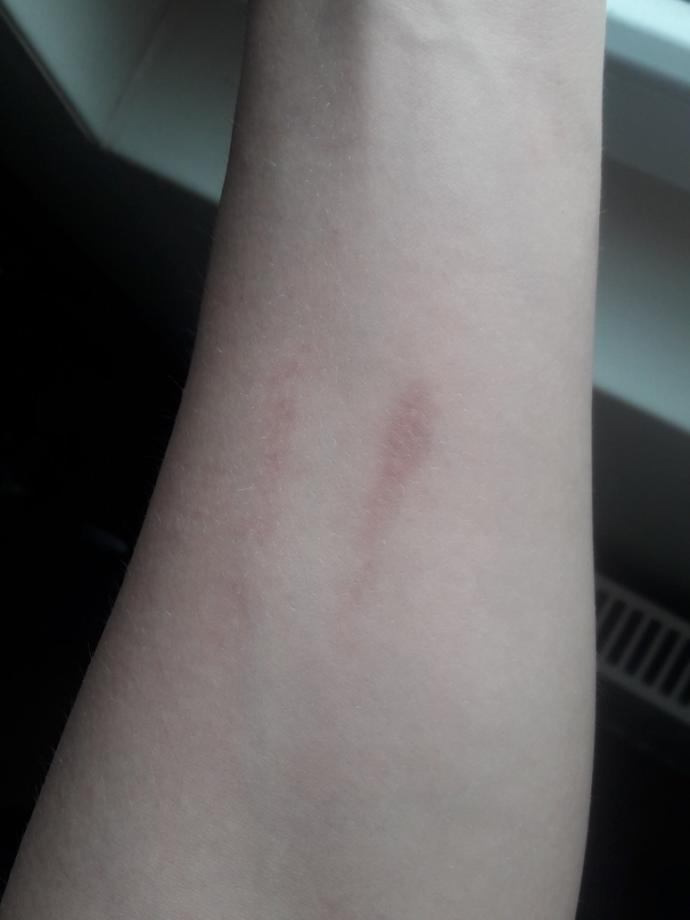 Do you have any large scars?