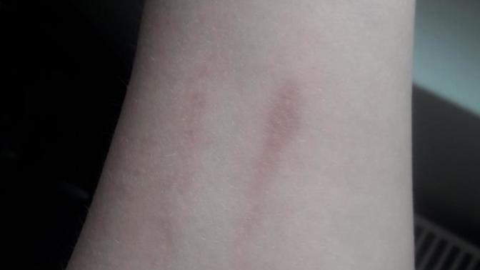 Do you have any large scars?