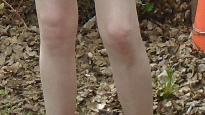 Girls, Do I have good looking legs/thighs/knees?