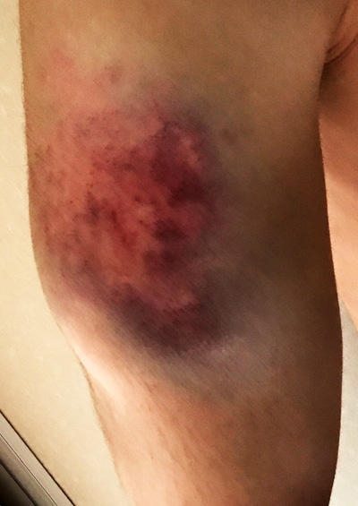 What would be the first few things you'd try if you found out you were completely impervious to physical harm?