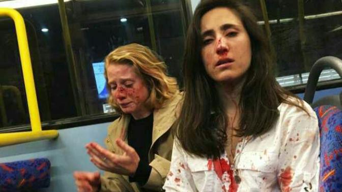 Lesbian couple beaten up for refusing to kiss for men's entertainment. Opinions?