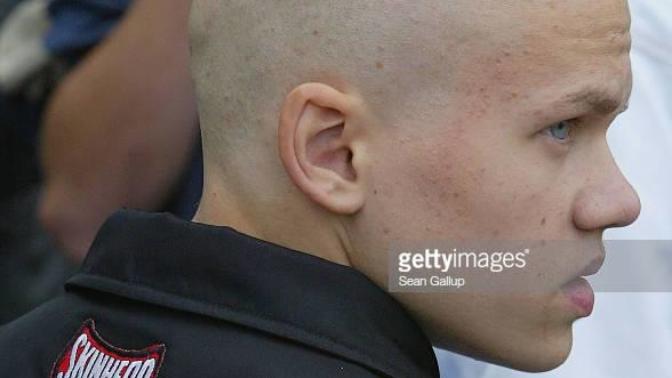 As a skinhead, should I tan my head?
