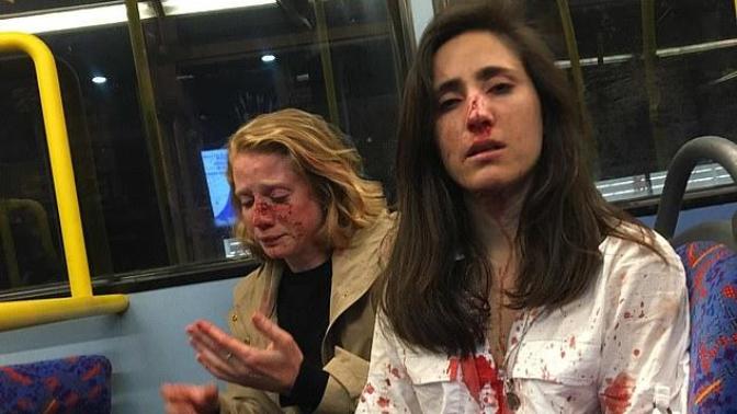 Don't you agree that the violence against women ONLY agenda is a slap in the face to everybody else?