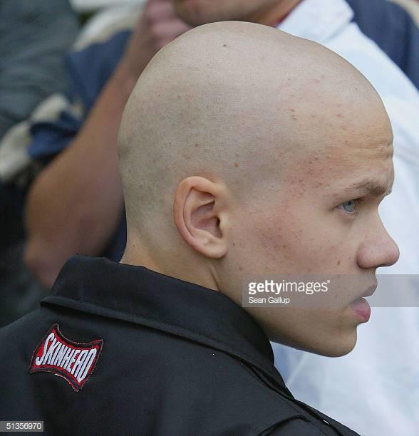 Need urgent advice please: should I tan my head?