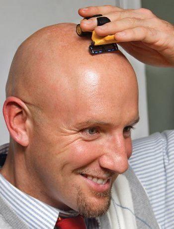Need urgent advice please: should I tan my head?