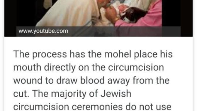 Do you think you have the right too decide whether your child should be circumcised?