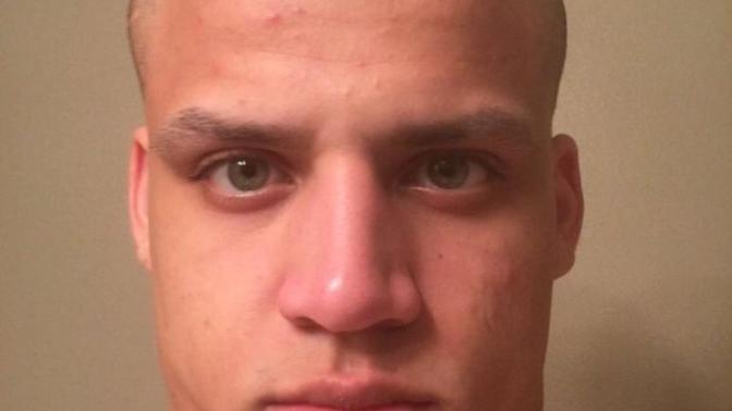 Why Are Many Guys Heads Deformed And Shaped Weird? Have You Ever Seen A Guy With A Weird Shaped Head?