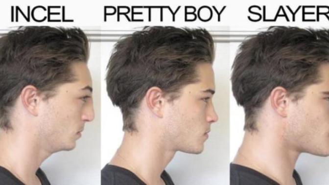 Should incels just invest in surgery?