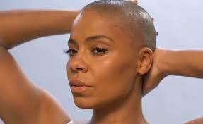 White people, would you rather be bald or have moderate acne (both permanently)?
