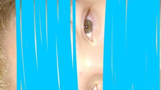 Heterochromia, brown and green?