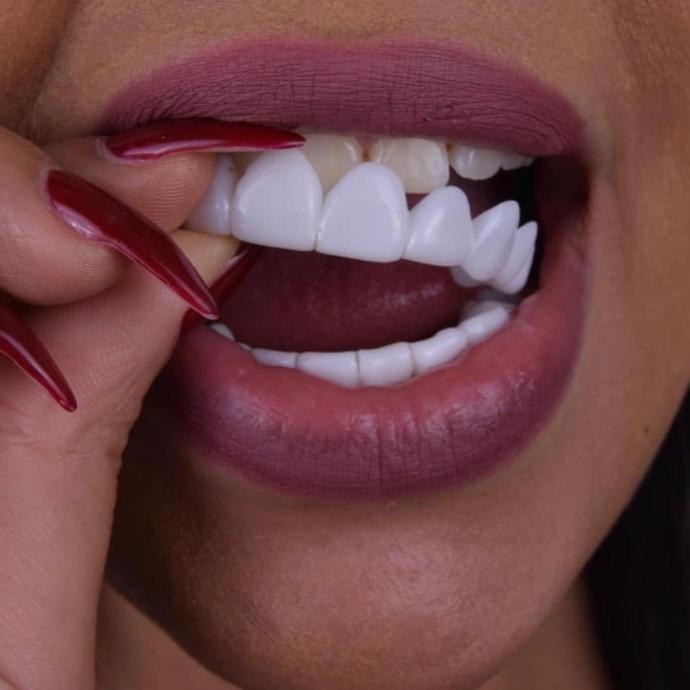 Would you try secret veneer?
