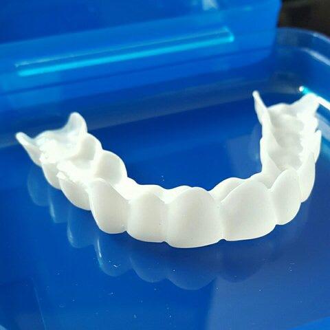 Would you try secret veneer? - GirlsAskGuys