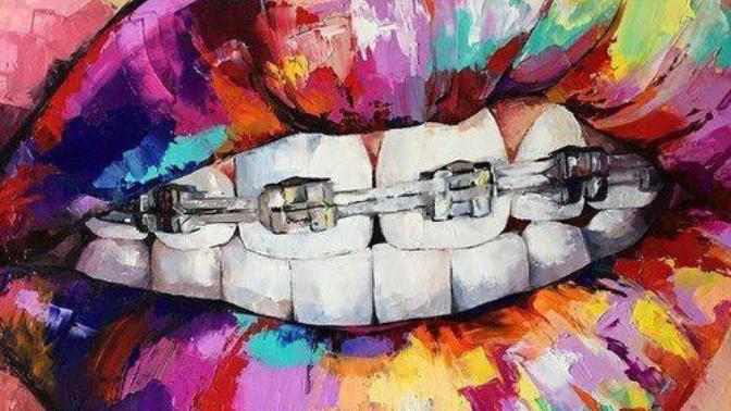 Have You Ever Worn Braces?