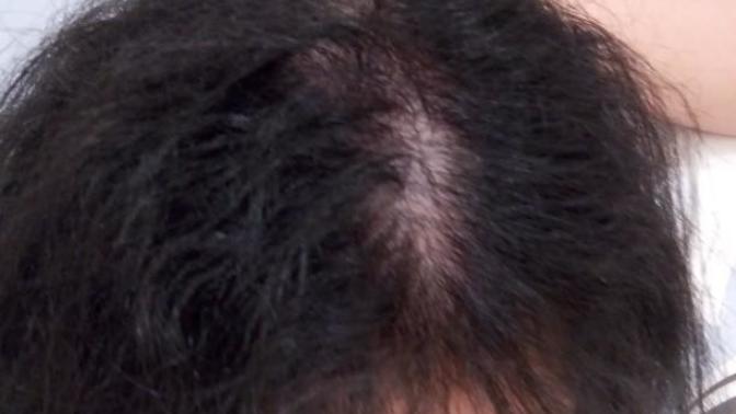 Am I balding or is this just fine?