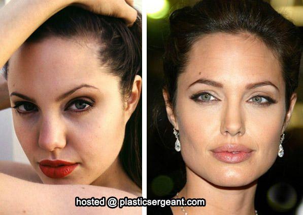 Why Do The Big Nose On Middle-Eastern Stereotype Exist?