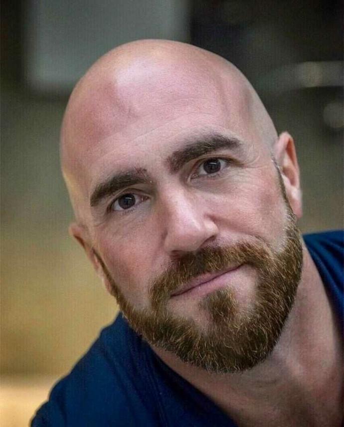 Women of G@G do you find bald men attractive or unattractive?