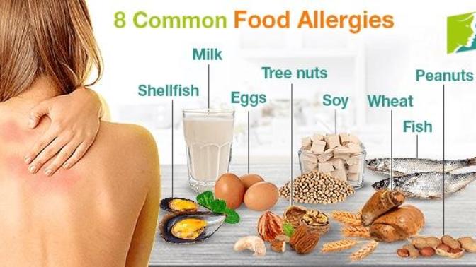 What are you allergic to?