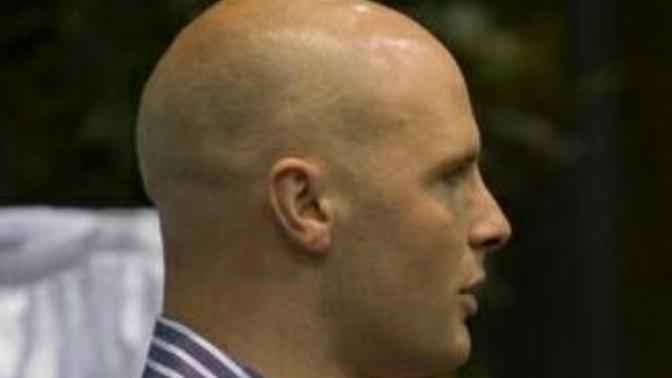 Why do guys do this stupid "bald with a beard" thing?