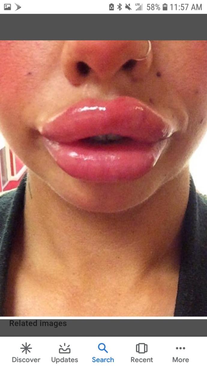 If there were only two kinds of lips what would you choose?