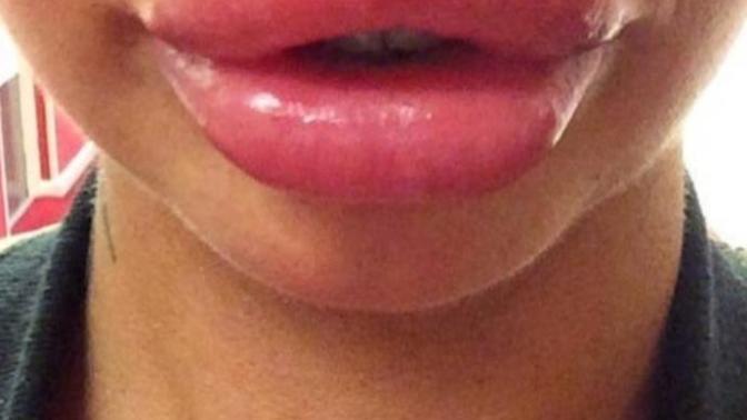 If there were only two kinds of lips what would you choose?