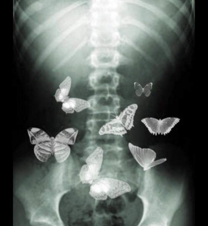 Do guys get butterflies in their stomach too?