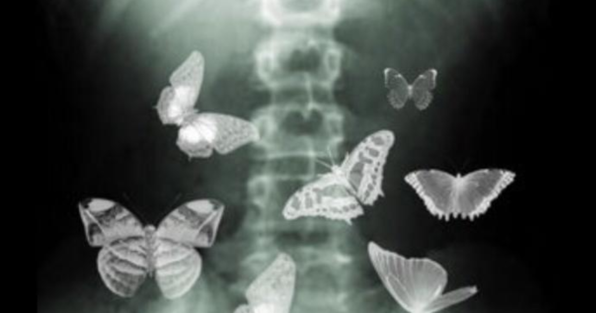 Do guys get butterflies in their stomach too? GirlsAskGuys