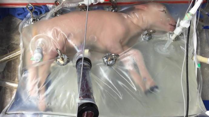 Would artificial wombs end the Pro-life vs Pro-choice conflict?