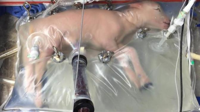 Would artificial wombs end the Pro-life vs Pro-choice conflict?