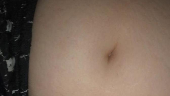 Men; how do you feel about stretch marks on a woman?
