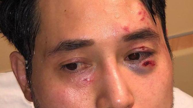 A gay, Asian, Journalist was beaten and had an alkali "milkshake" (burns similar to acid) thrown at him in Portland by masked white men. Is this okay?