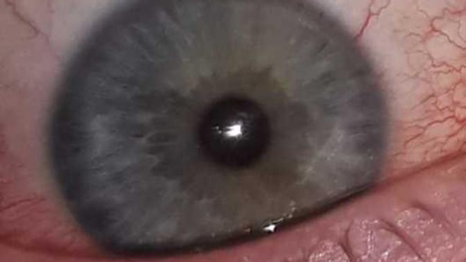 What color are youe eyes?