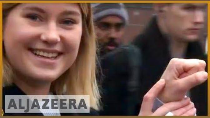 What Do You Think About the Microchip Implants? Would You Do It?