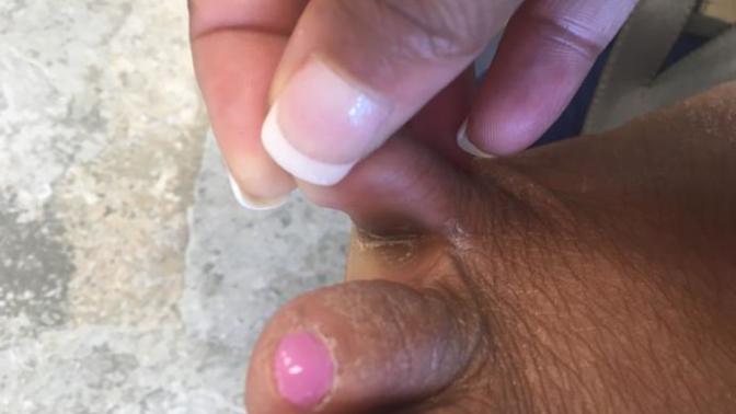 Uh... is this athlete’s foot?