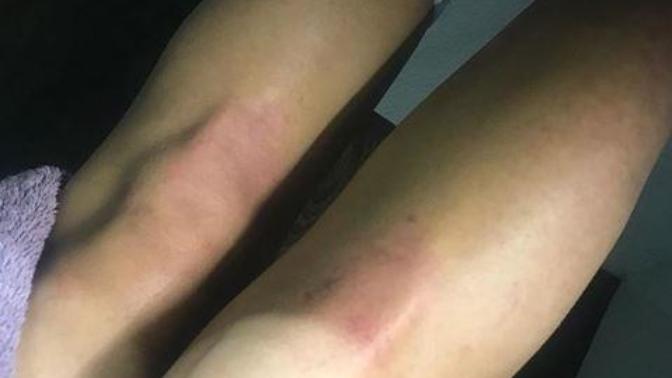 Girls, do these legs look shaved?