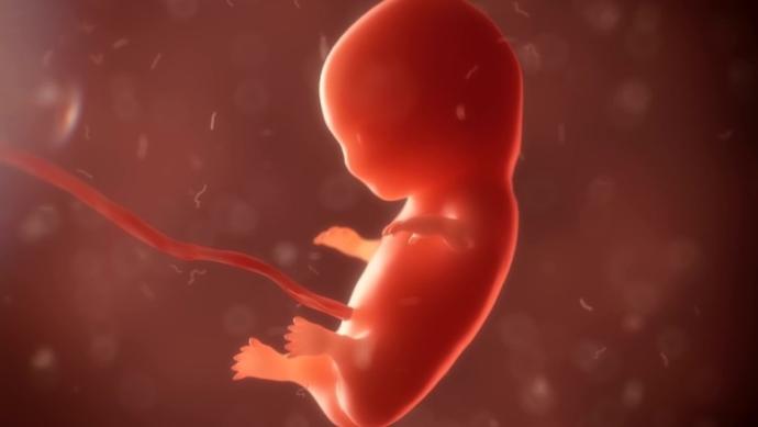 Should women that have an abortion be jailed?